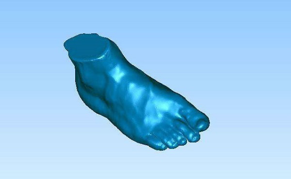 醫療3D打印機定制矯正器(圖4) 醫療3D打印機定制矯正器(圖4)