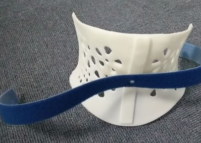 醫療3D打印機定制矯正器(圖2) 醫療3D打印機定制矯正器(圖2)