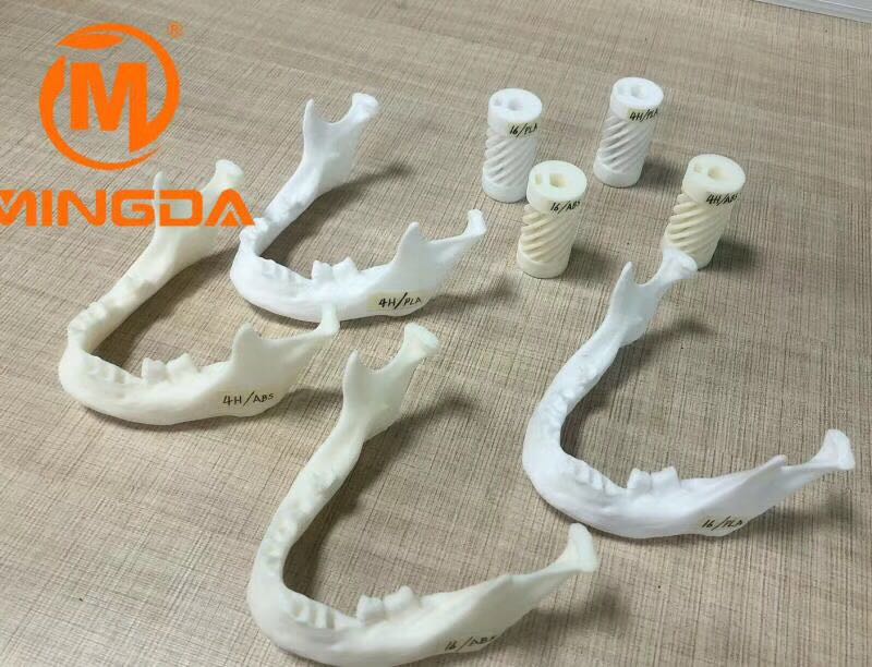 工業級3D打印機在牙科行業的應用(圖1) 工業級3D打印機在牙科行業的應用(圖1)