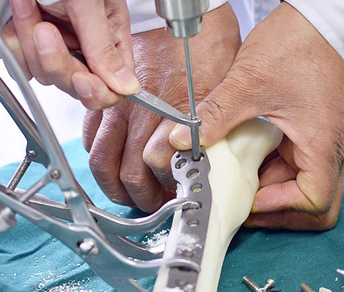 3D打印技術(shù)在骨科的實際應(yīng)用有哪些?(圖2) 3D打印技術(shù)在骨科的實際應(yīng)用有哪些?(圖2)